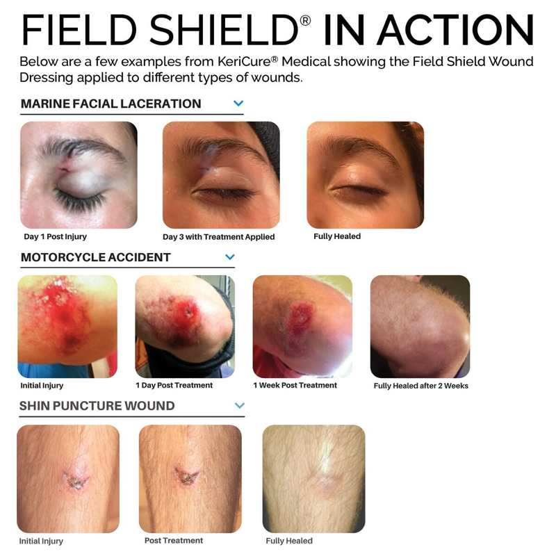 North American Rescue Military Grade Field Shield Wound Dressing 0.5 oz
